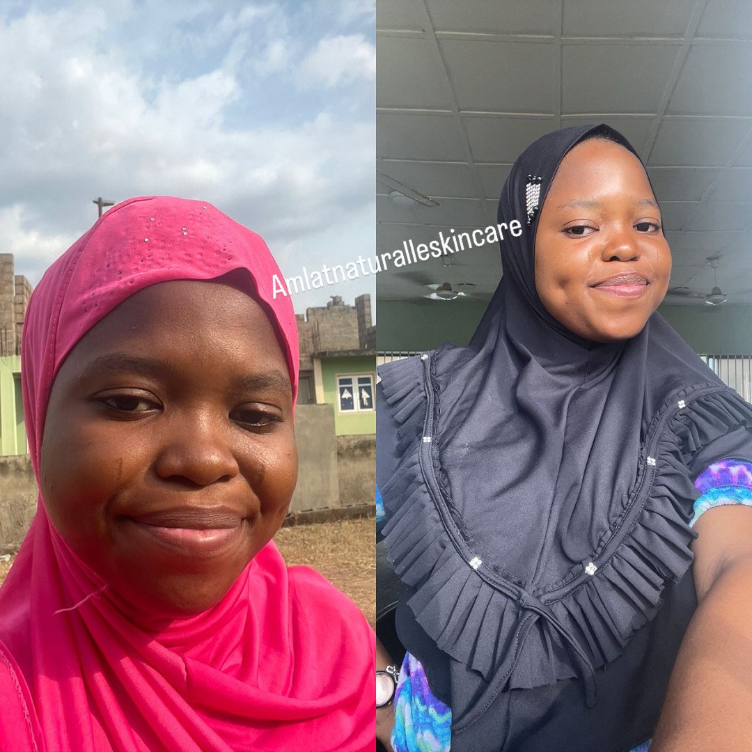 Aisha B. Amlat Ultra Glow Kit result